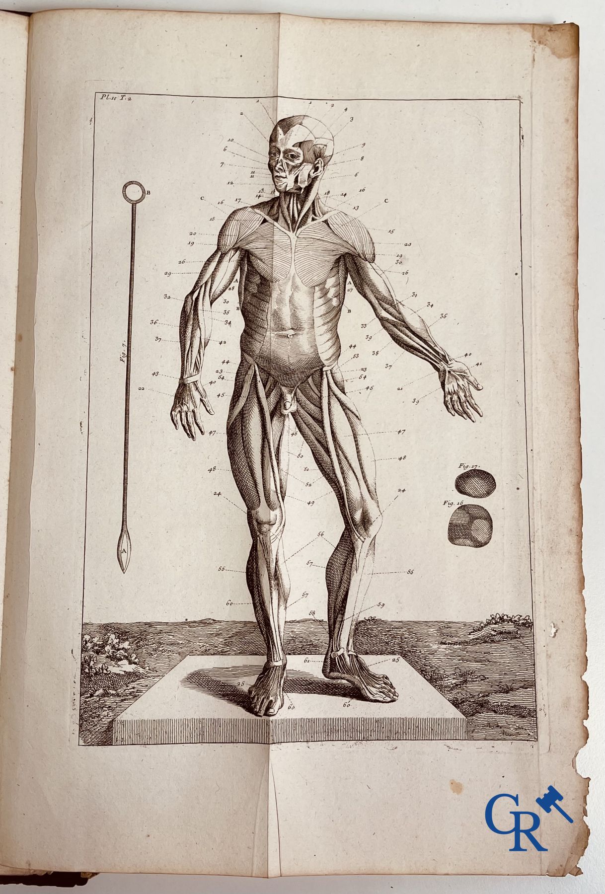 Oude boekdrukken: Dictionnaire Universel de Medecine, Robert James. 6 volumes, Paris 1746-1748.