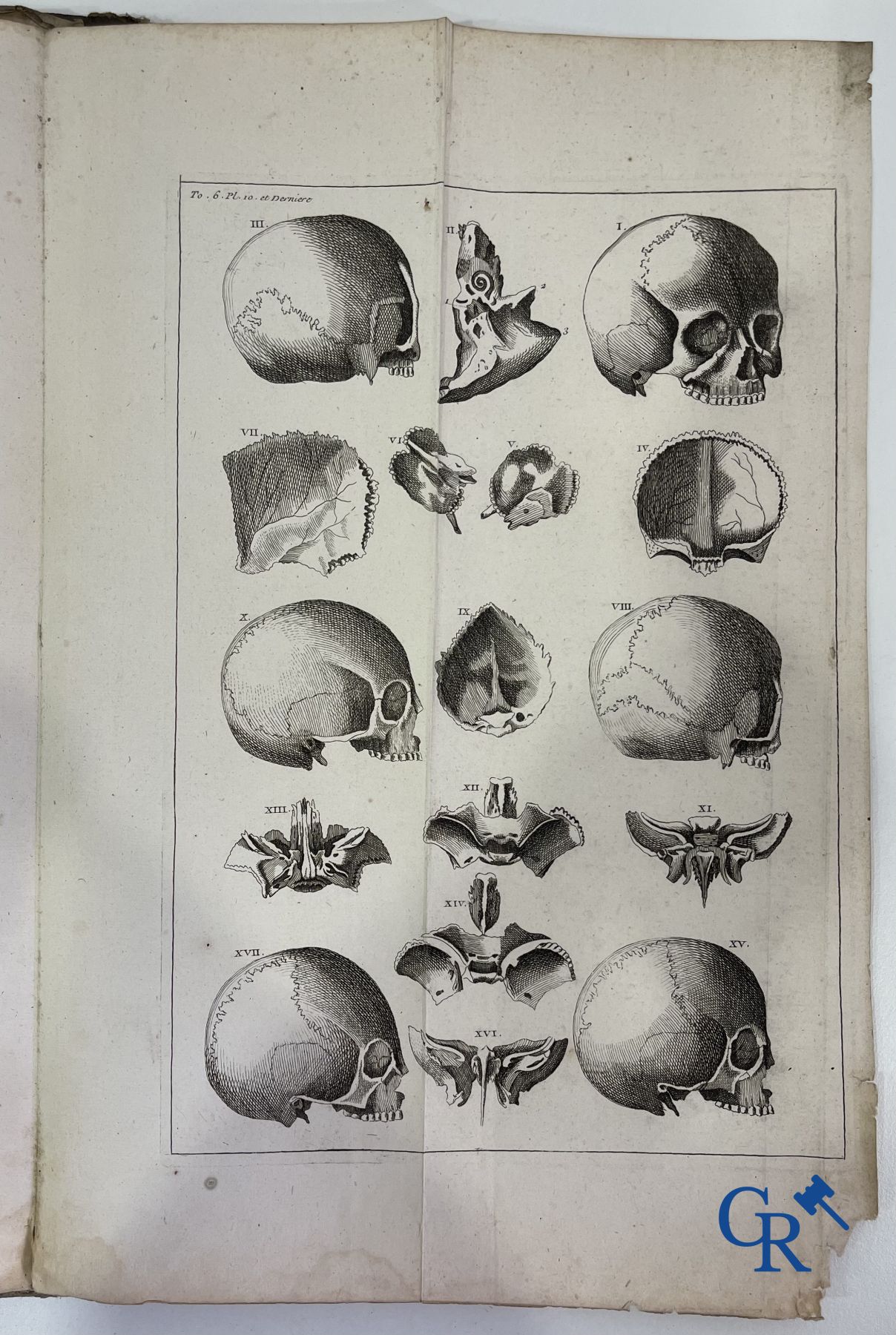 Early printed books: Dictionnaire Universel de Medecine, Robert James. 6 volumes, Paris 1746-1748.