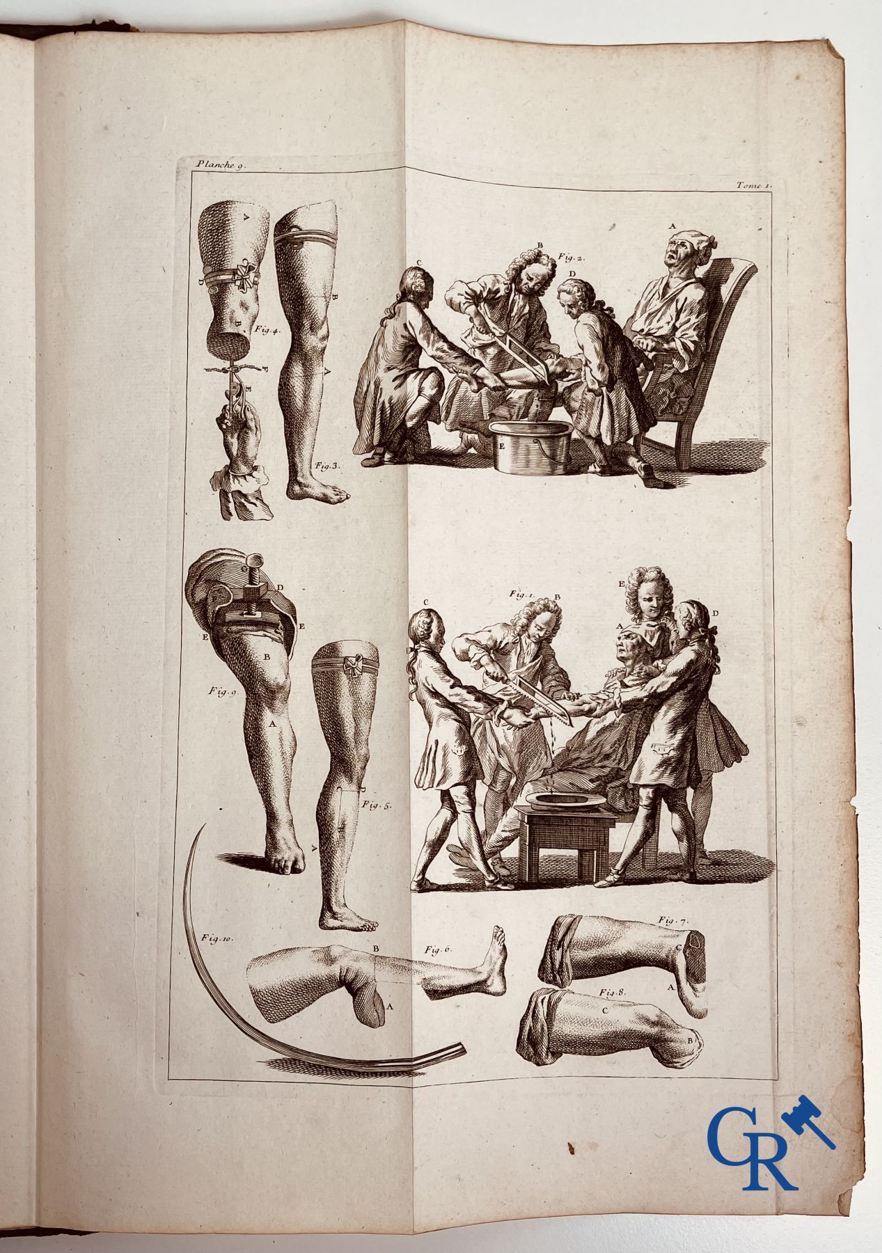 Early printed books: Dictionnaire Universel de Medecine, Robert James. 6 volumes, Paris 1746-1748.